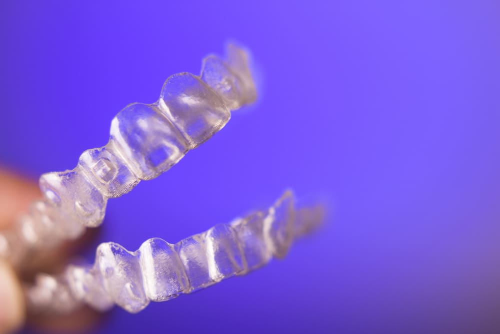 invisalign braces