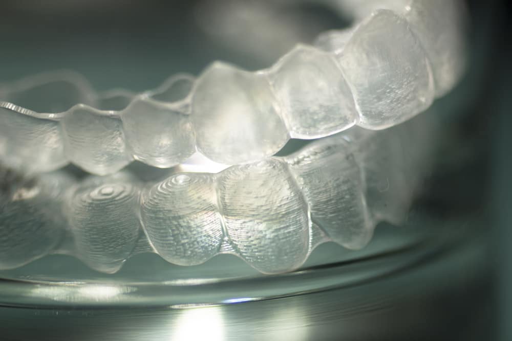 invisalign braces